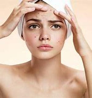 Acne - Some Alternative Therapies