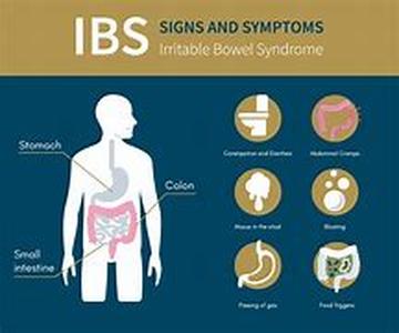 Irritable Bowel Syndrome