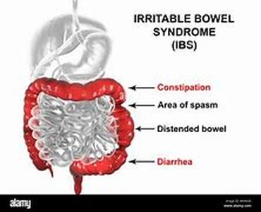 Irritable Bowel Syndrome  Neuroendocrine