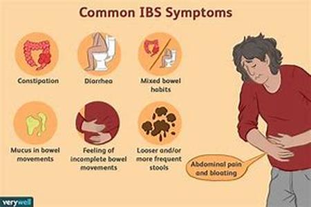 Irritable Bowel Syndrome Symptoms