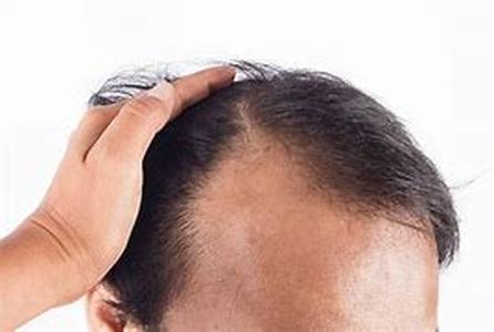 Those with bad credit often know exactly why they have it