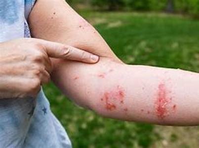 Pains during Growth in Children