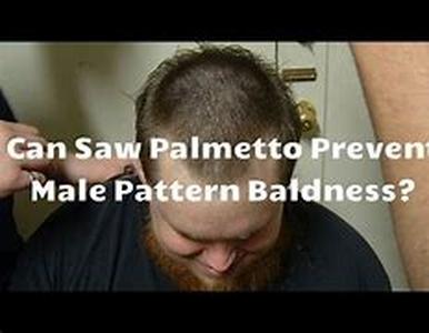 Saw Palmetto for Hair Regrowth  Making Possibilities  The hair undergoes different cycles  growing, resting and shedding
